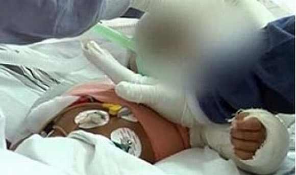 Baby Falak was admitted to AIIMS on January 18