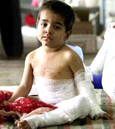 A child injured in the 2002 riots sits inside an Ahmedabad mosque after his father took shelter there.