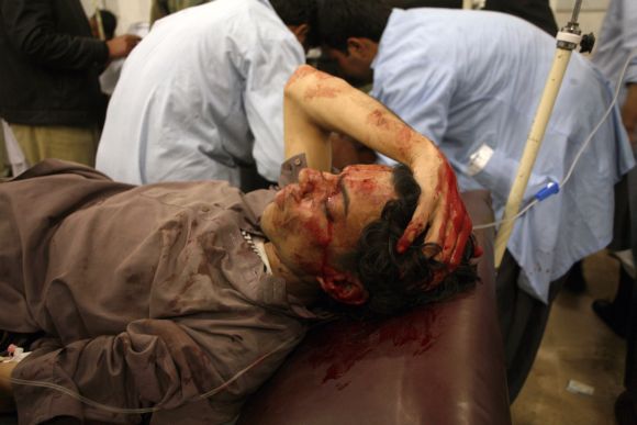 An injured man lies in a hospital after the second bomb blast in Quetta