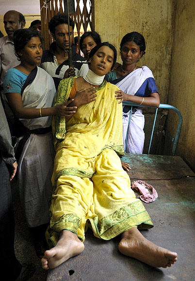 Serina Bibi was injured in a bomb blast recuperates in a local hospital at Domkol in Berhampore