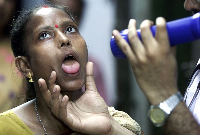 An Indian doctor examines a sex worker suffering from tuberculosis at a health clinic for prostitutes in Kolkata. Photograph: Jayanta Shaw/Reuters