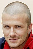 David+beckham+hair+loss