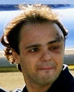 Felipe Massa