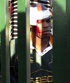 A soccer fan injured in a stampede outside the stadium in Tembisa