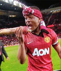 23evra-arm.jpg