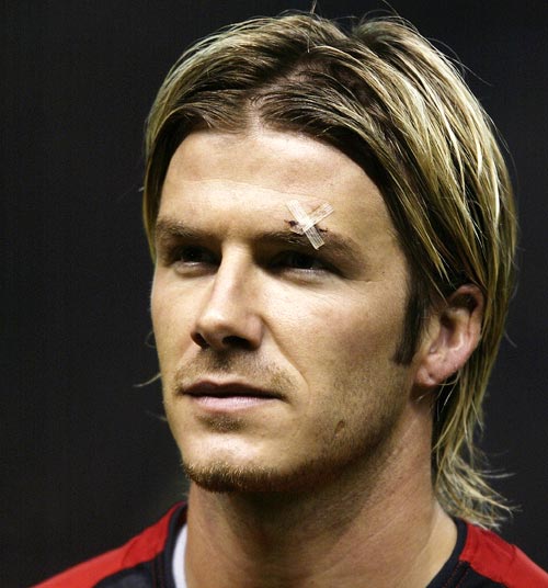 David Beckham with the infamous cut above his left eye in Feburary 2003
