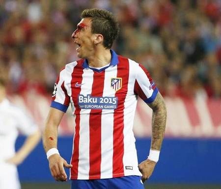 Atletico Madrid's Mario Mandzukic walks off the pitch to receive treatment after sustaining a head injury