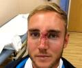 England name injured Broad in squad for fifth India Test