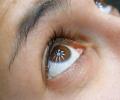 What is dry eye syndrome? Do you have it?