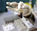 Gilead to allow 5 Indian firms to sell hepatitis generics in 90 countries