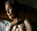This 86-yr-old lives with the scars of Hiroshima and Nagasaki