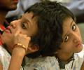 These conjoined sisters have given up eating for Salman