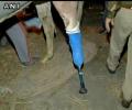 Shaktiman stands on prosthetic limb; amputation successful