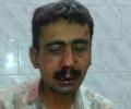 'Telegraph' employee attacked in Patna