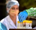 Serum to produce up to 100 mn Covid vaccine doses for India, others