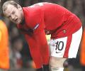 Rooney suffers burst blood vessel in ankle