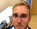 England name injured Broad in squad for fifth India Test