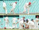 10 critical injuries on the cricket field