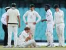 Australia's Green struck on head during warm-up match