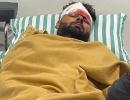 Rishabh Pant 'stable' after car accident in Roorkee