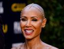 Understanding Alopecia, Jada's hair loss condition