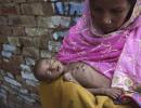 India tops world hunger list with 194 million people