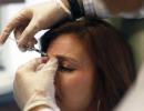 How Allergan plans to boost Botox sales in Indian market