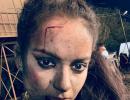 Has Kangana been in a brawl?