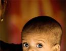 3000 children die of malnutrition in India everyday