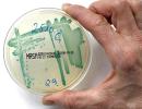 Fear the superbug? Go easy on the antibiotics