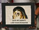 17 months, 20 surgeries: Sikar gang rape victim still awaits justice