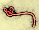 Here's what you MUST know about the deadly Ebola virus