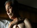 This 86-yr-old lives with the scars of a nuclear war