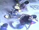 Telangana: Three minors at childcare centre 'burnt' with hot spoons as punishment