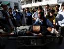 80 dead, 231 injured in Kabul suicide attack