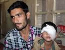 CRPF sorry for pellet injuries in Kashmir