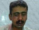 'Telegraph' employee attacked in Patna