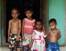 Modi must worry about India's malnutrition crisis