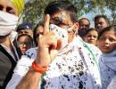 Ink thrown at AAP MP Sanjay Singh in Hathras