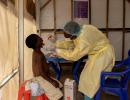 Mpox a global public health emergency: WHO