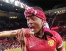 Evra pokes fun at Suarez, bites into fake arm