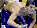 Here's why Phelps has those big red circles all over his back