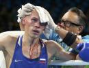 PHOTOS: 7 horrifying injuries at the Rio Games