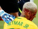 Neymar left bloodied in Brazil's thumping win; Argentina held