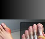 8 Foods That Cause A Build-Up Of Uric Acid