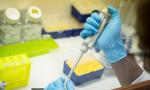 Delhi diagnostic players oppose genetic sample outflow ban