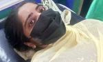 Delhi girl fakes acid attack with 'toilet cleaner'; father held