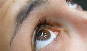 What is dry eye syndrome? Do you have it?