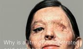 How an acid attack survivor walked into the world's heart!