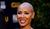 Understanding Alopecia, Jada's hair loss condition